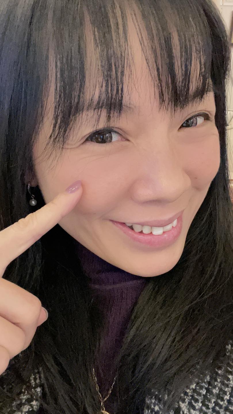 【皮秒雷射】古亭星和診所- 葉姿辰醫師-又到了進廠維修時間， 之前看到朋友皮秒療程後素顏也超美的模樣， 真讓人羨慕不已 ！！！～-花花的低醣世界sunny's LCHF world